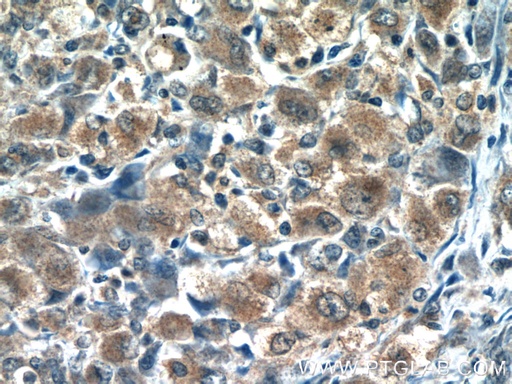 [13290-1-AP-20UL] RNF125 Polyclonal antibody