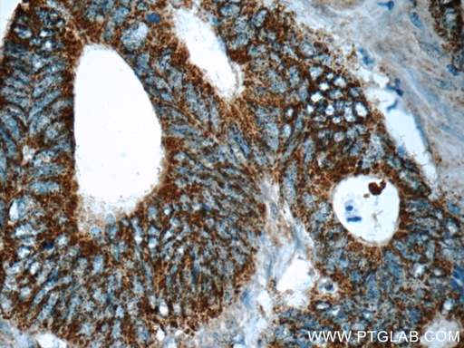[13293-1-AP-150UL] MS4A12 Polyclonal antibody