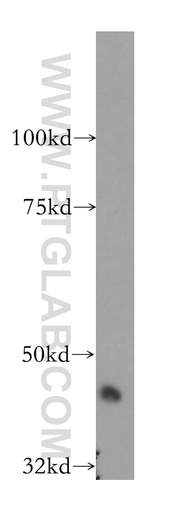 [13298-1-AP-150UL] SERPINI2 Polyclonal antibody