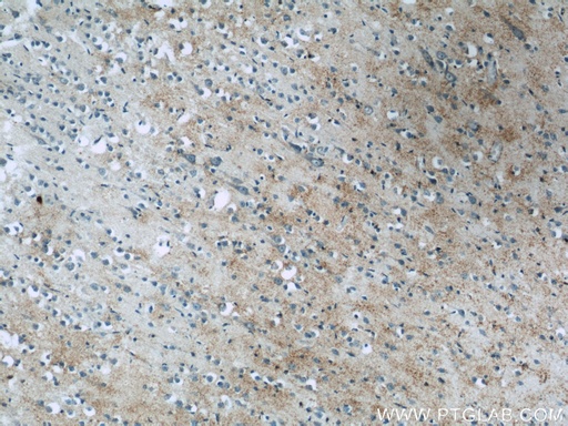 [13299-1-AP-20UL] BNP Polyclonal antibody