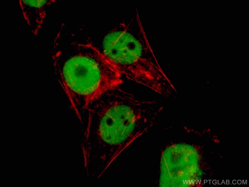 [13300-1-AP-20UL] TRIB3 Polyclonal antibody