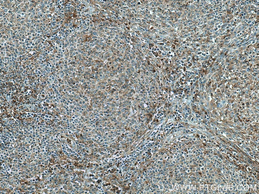 [13301-1-AP-150UL] Syntaxin 11 Polyclonal antibody