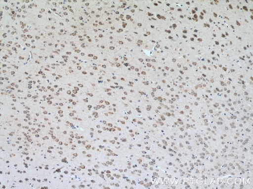 [13302-1-AP-150UL] CLSTN3 Polyclonal antibody