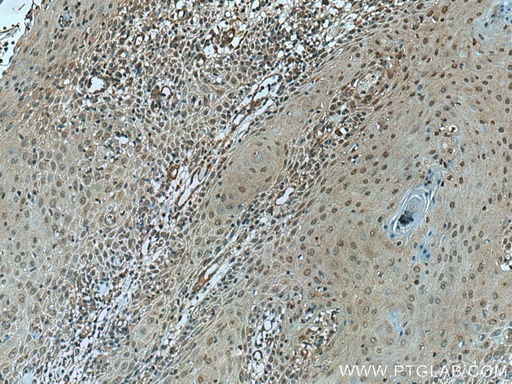 [13303-1-AP-20UL] VASH2 Polyclonal antibody