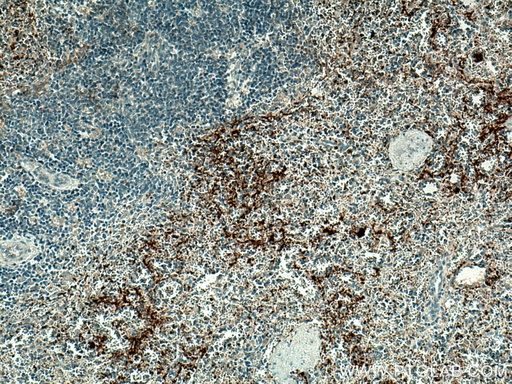 [13304-1-AP-20UL] P-selectin Polyclonal antibody