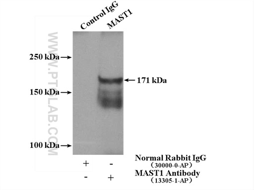 [13305-1-AP-150UL] MAST1 Polyclonal antibody