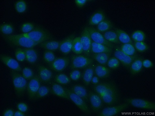 [13310-1-AP-150UL] ATP2C1 Polyclonal antibody