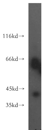 [13311-1-AP-150UL] TRAM2 Polyclonal antibody
