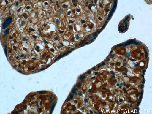 [13313-1-AP-20UL] PPBP,NAP2 Polyclonal antibody