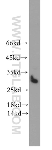 [13316-1-AP-150UL] STOML3 Polyclonal antibody