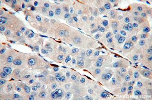 [13317-1-AP-20UL] Cytoglobin Polyclonal antibody