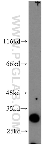 [13320-1-AP-20UL] SLC17A5 Polyclonal antibody