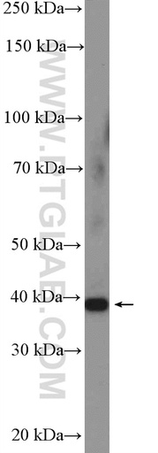 [13321-1-AP-150UL] TSG-6 Polyclonal antibody