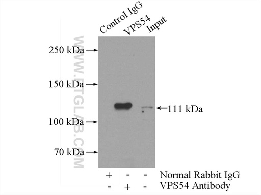 [13327-1-AP-150UL] VPS54 Polyclonal antibody