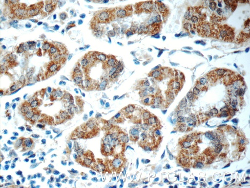 [13328-1-AP-20UL] ADA Polyclonal antibody