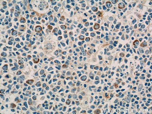 [13332-1-AP-20UL] CD94 Polyclonal antibody