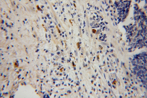 [13333-1-AP-150UL] HK3 Polyclonal antibody