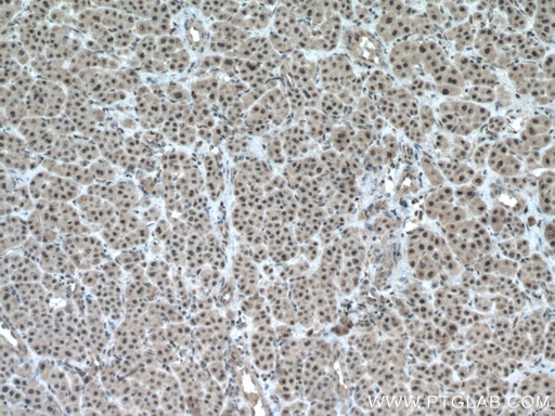 [13341-1-AP-20UL] TAF1C Polyclonal antibody