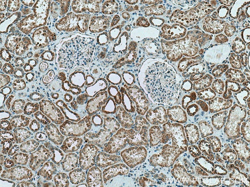 [13342-1-AP-20UL] CA5B Polyclonal antibody