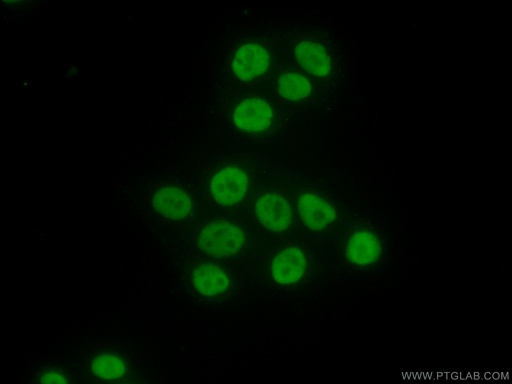 [13347-2-AP-20UL] MCM6 Polyclonal antibody