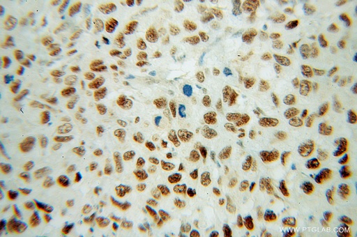 [13349-1-AP-150UL] FBLIM1 Polyclonal antibody