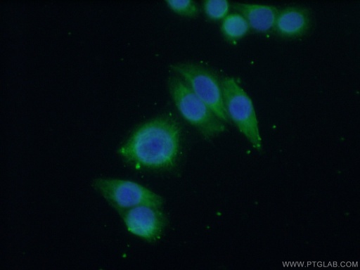 [13350-1-AP-20UL] GNA14 Polyclonal antibody