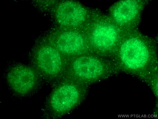 [13358-1-AP-20UL] RAD17 Polyclonal antibody