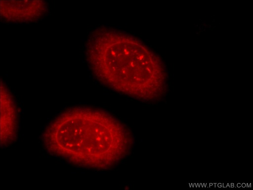 [13359-1-AP-20UL] TDRD3 Polyclonal antibody