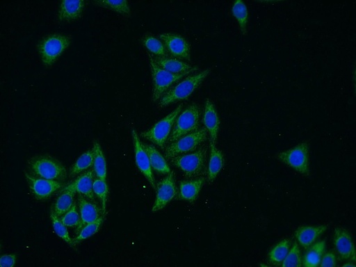 [13360-1-AP-20UL] Glycerokinase Polyclonal antibody