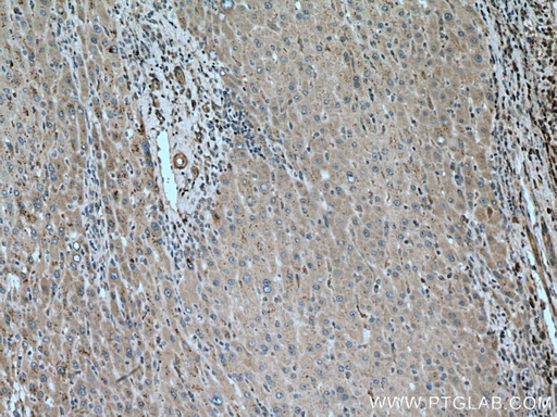 [13361-1-AP-150UL] PIP5K3 Polyclonal antibody