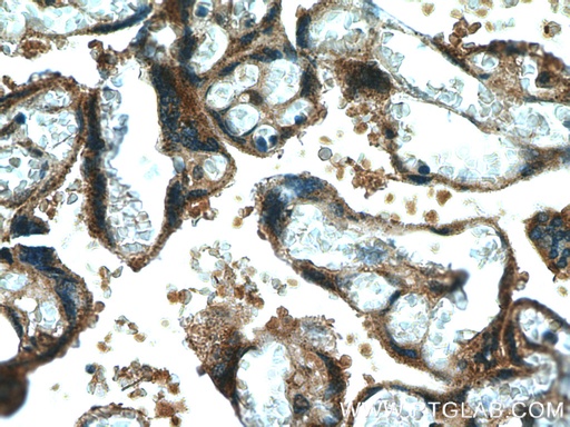 [13363-1-AP-20UL] CYP11A1 Polyclonal antibody