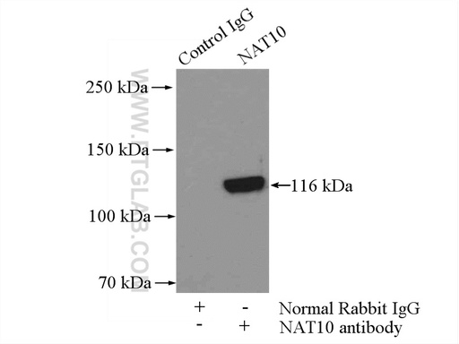 [13365-1-AP-20UL] NAT10 Polyclonal antibody