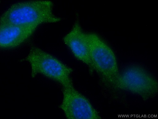[13366-1-AP-150UL] PPP1R12B Polyclonal antibody