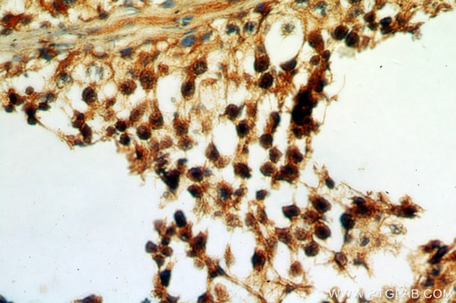 [13367-1-AP-20UL] SPA17 Polyclonal antibody