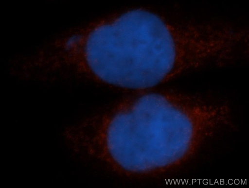[13372-1-AP-150UL] TFEB Polyclonal antibody