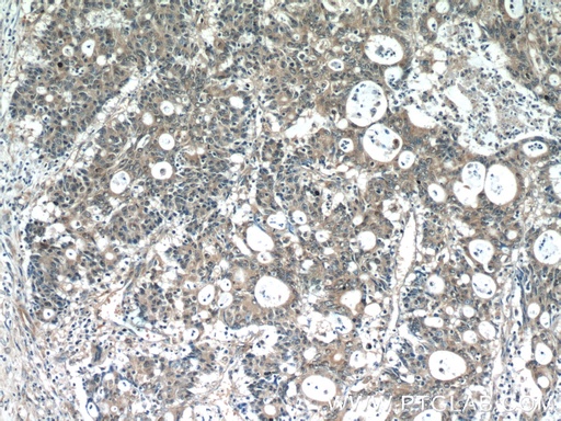 [13375-1-AP-20UL] SCFD2 Polyclonal antibody