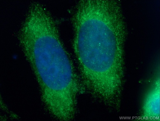 [13376-1-AP-150UL] CDC20B Polyclonal antibody