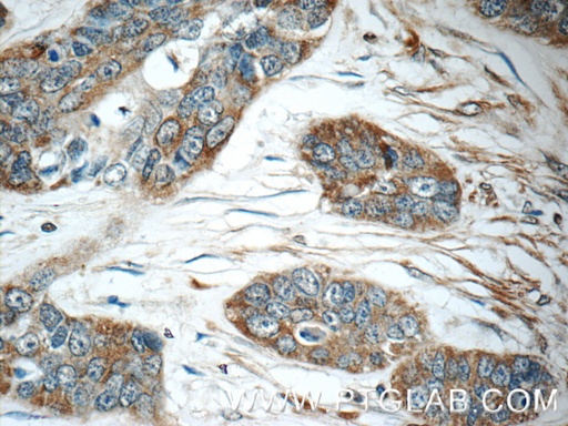 [13378-1-AP-150UL] IFIT5 Polyclonal antibody