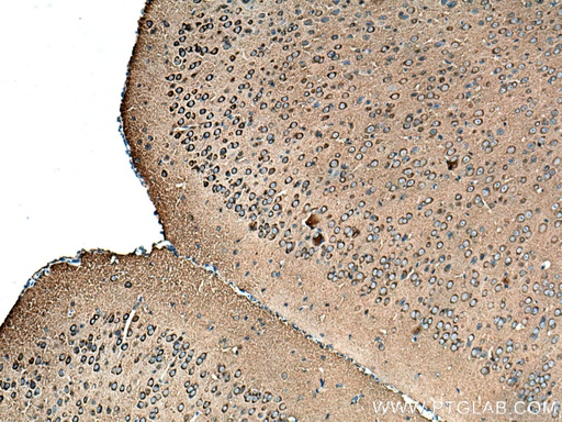 [13379-1-AP-20UL] Amphiphysin Polyclonal antibody