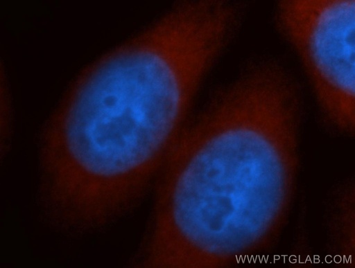 [13382-1-AP-150UL] NCAPD2 Polyclonal antibody