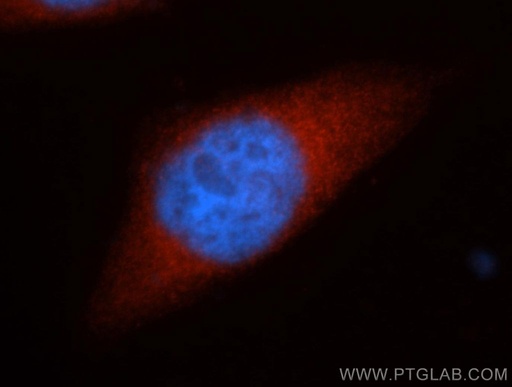 [13383-1-AP-150UL] HSPH1 Polyclonal antibody