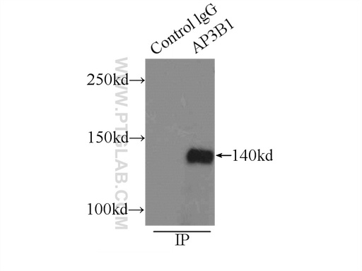 [13384-1-AP-150UL] AP3B1 Polyclonal antibody