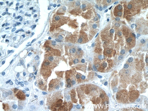 [13388-1-AP-20UL] IHH Polyclonal antibody