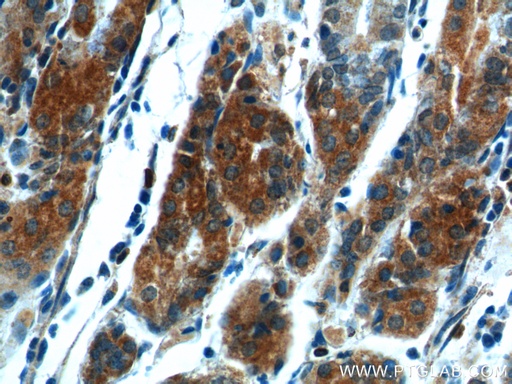 [13393-1-AP-20UL] COX-1/Cyclooxygenase-1 Polyclonal antibody