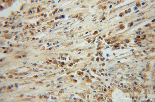 [13394-1-AP-150UL] CLEC1A Polyclonal antibody