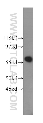 [13396-1-AP-150UL] B4GALNT1 Polyclonal antibody