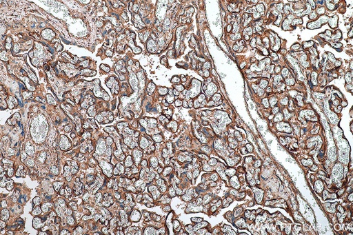 [13398-1-AP-150UL] GPR161 Polyclonal antibody