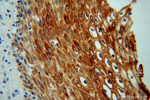 [13403-1-AP-20UL] KIF22 Polyclonal antibody