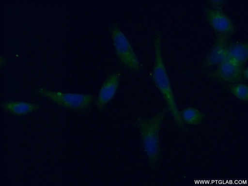[13405-1-AP-20UL] TRIM38 Polyclonal antibody