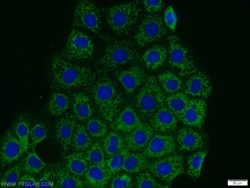 [13408-1-AP-150UL] PHACTR4 Polyclonal antibody